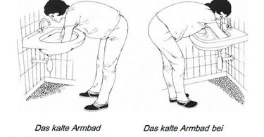 Armbad nach Kneipp