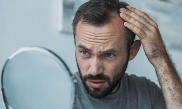 Haartransplantation in der Türkei: Wann sie bei Haarausfall infrage kommen kann